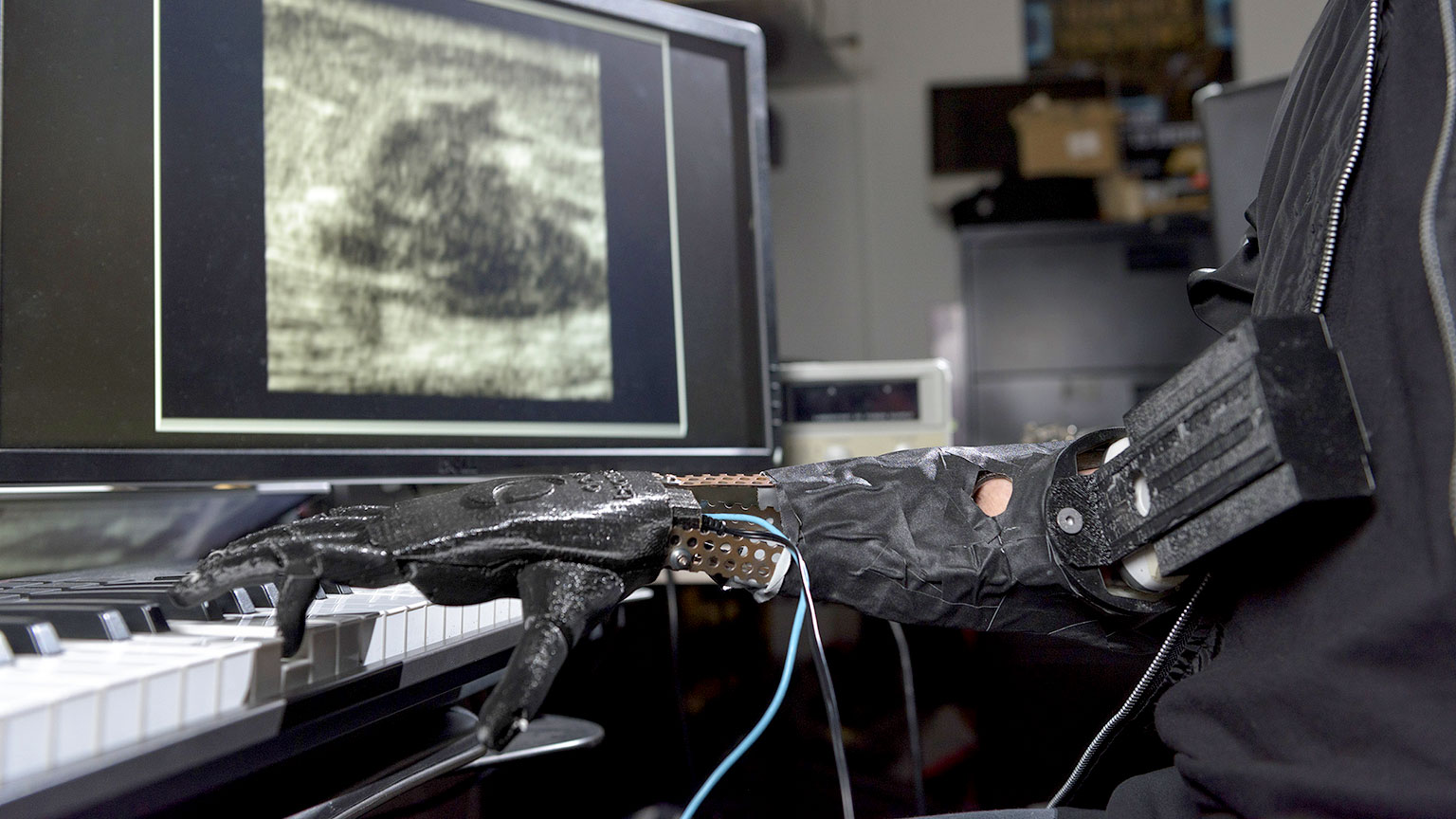 A robotic prosthetic hand called the "Skywalker Hand" invented by the Center for Music Technology, plays a keyboard.